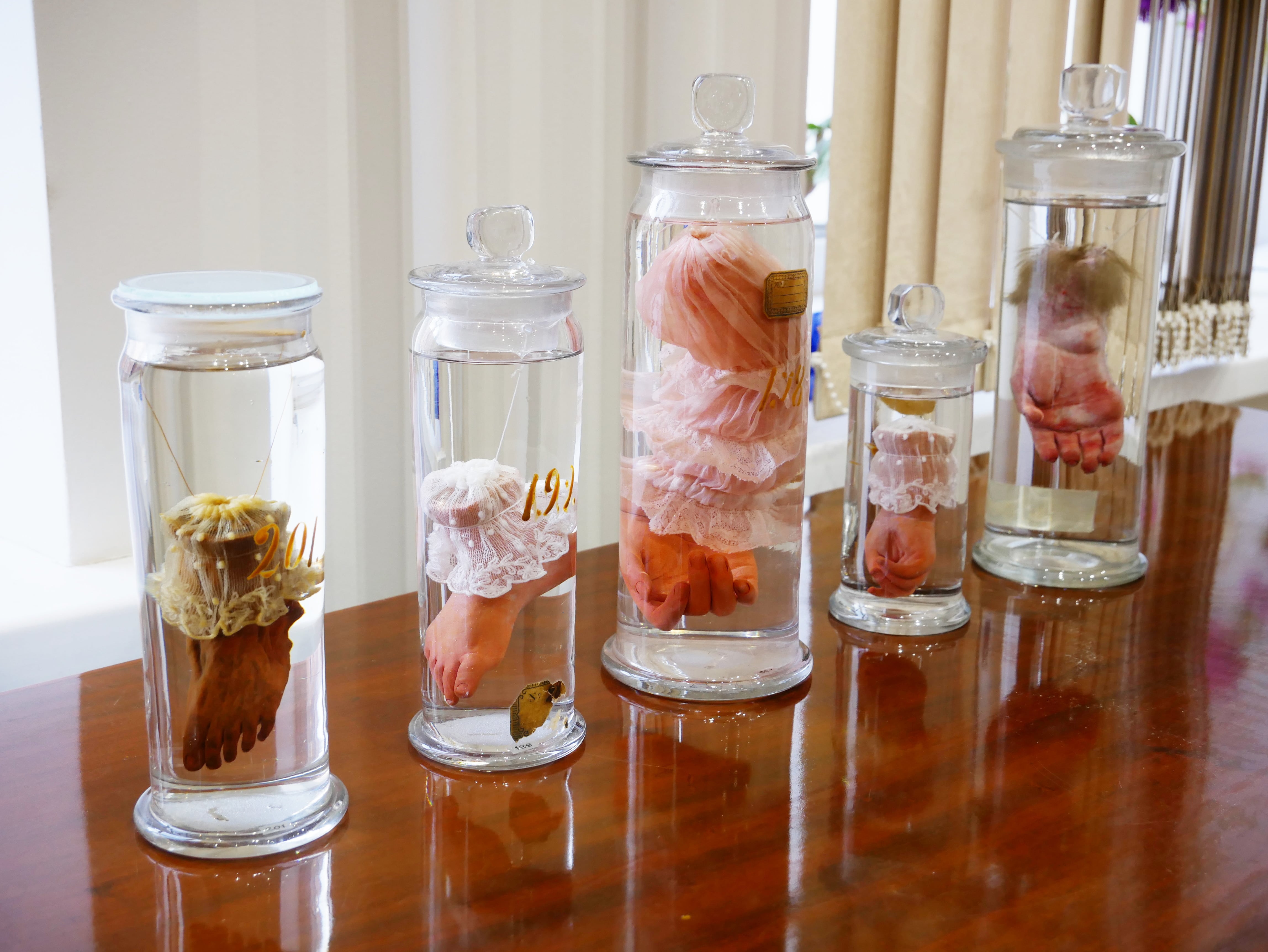 консервация анатомических препаратов. для консервации анатомических препаратов применяется. показания для применения раствора формальдегида:. раствор формальдегида. 40 раствор формальдегида в воде.