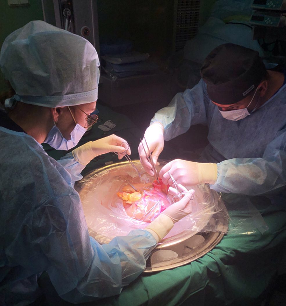 В Военно-медицинской академии выполнено 7 ортотопических трансплантаций печени за последний квартал 2021 года