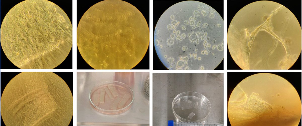 Исследование динамики процесса адгезии клеток на различных биорезорбируемых носителях в культуре in vitro
