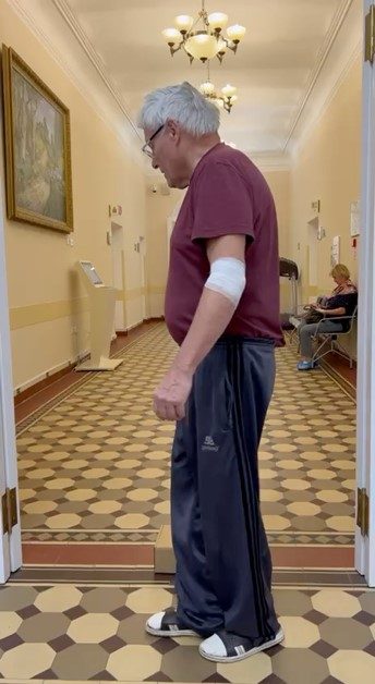 Использование инновационного оборудования для коррекции нарушения ходьбы центрального уровня у пациента с болезнью Паркинсона