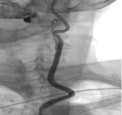 Левые ОСА-ВСА